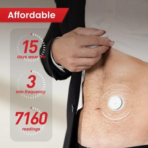 Sinocare iCan Continuous Glucose Monitoring (CGM) System Glucometer 24h x 15Days Real-time Blood Glucose Monitor for Diabetes Management